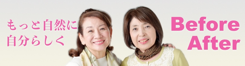 大阪の増毛エクステ 薄毛 安い